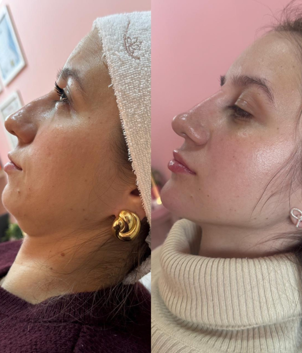 Design sem nome (32)